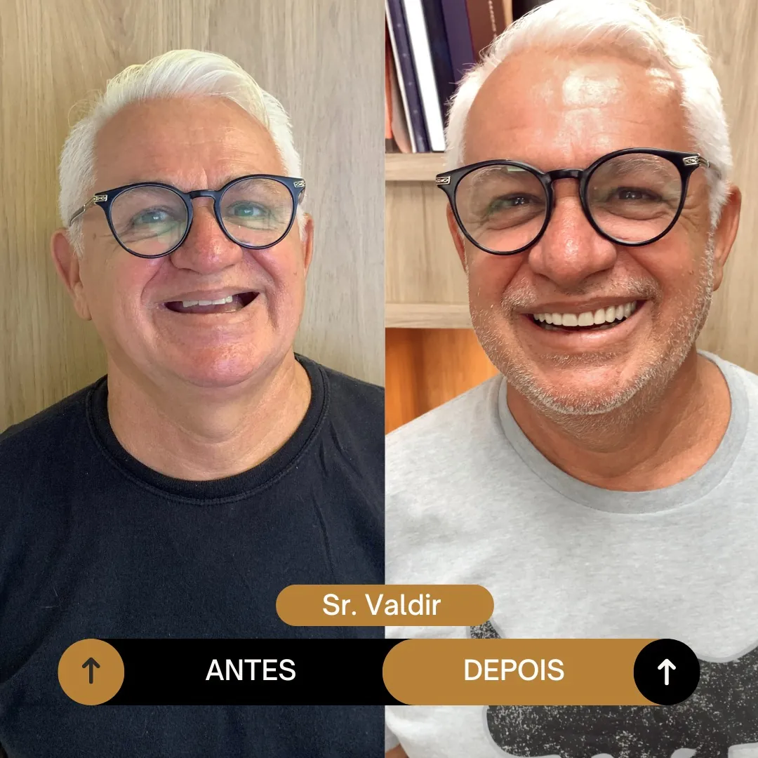 HOMEM